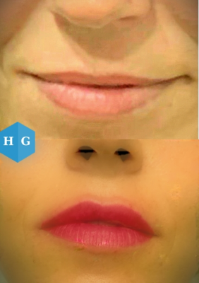 Foto Gonz�lezEst�ticaFacial (Centro Est�tico 2020)